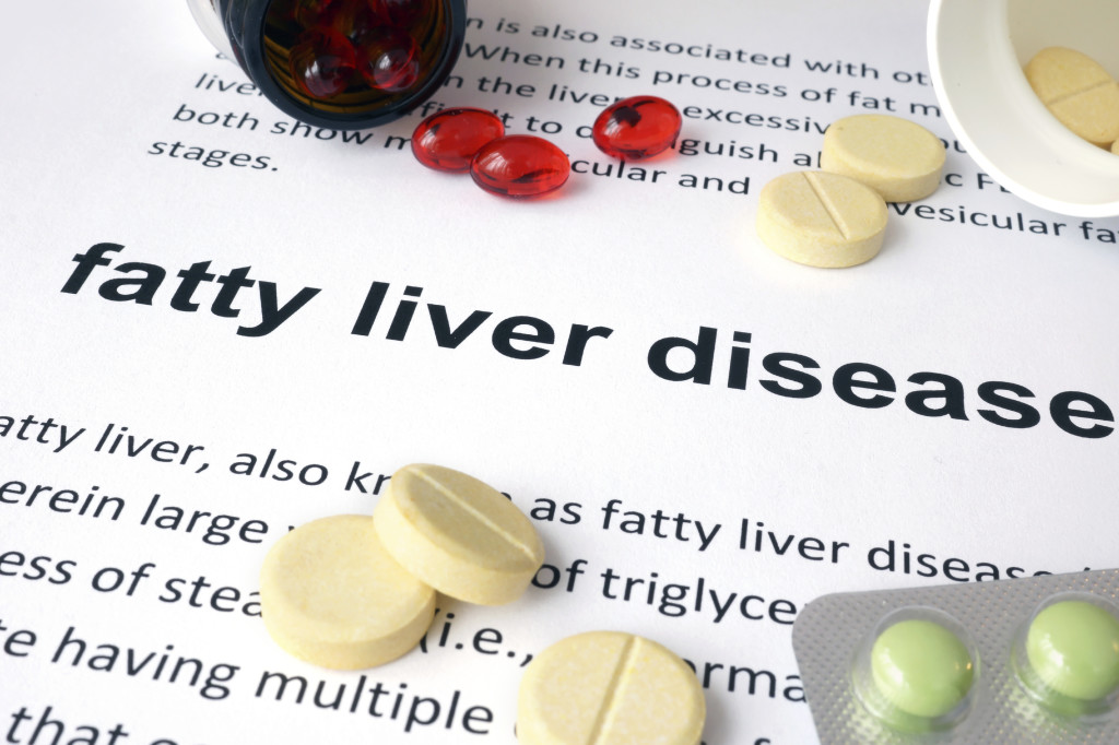 4 Tips To Reverse Fatty Liver Disease